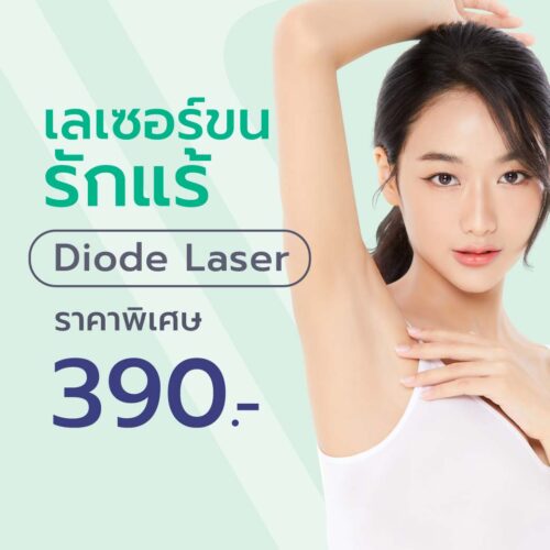 Diode Laser รักแร้